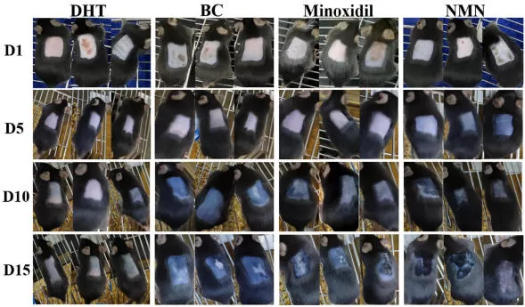 NMNと育毛: アンドロゲン性脱毛症 (AGA) の新しい証拠